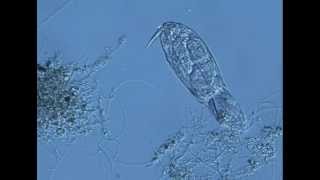 rotifer ingesting filamentous bacteria in activated sludgem1v [upl. by Christis995]