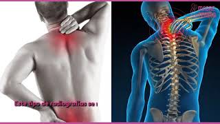 En qué consiste la radiografía de columna lumbosacra [upl. by Dody382]