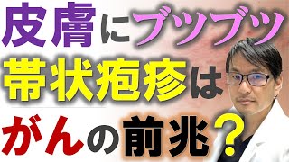 【注意：若い人では６倍超！】皮膚のブツブツ「帯状疱疹」はがんの前兆？ [upl. by Dhu]