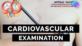 Cardiovascular Examination  OSCE Guide  UKMLA  CPSA [upl. by Leuqar110]