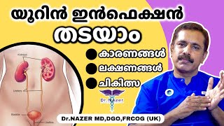 URINE INFECTION UTI MALAYALAM യൂറിൻ ഇൻഫെക്ഷൻ തടയാം  ലക്ഷണങ്ങൾ കാരണങ്ങൾ ചികിത്സ  Dr Nazer [upl. by Aihsinyt920]