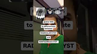 Radicular cyst VS Dentigerous Cyst dentistry dentistrytips dentaltips dentalstudent dental [upl. by Eadith576]