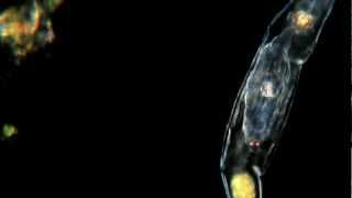 Baby on Board Rotifer With quotChildquot Amazing Microscopic HD Video [upl. by Oneill]