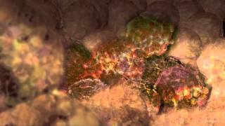 Cancer Cells Undergoing Mitosis [upl. by Eceeryt]