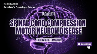 Tutorial 06 Spinal Cord Compression and Motor Neuron Diseases [upl. by Aciretnahs]