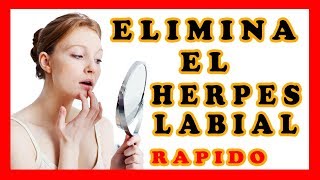 Como quitar el herpes labial rapido y las calenturas en los labios con remedios caseros Afta bucal [upl. by Clyve]