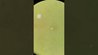 CSF sample with Cryptococcus neoformans fungi parasite fungus parasitology [upl. by Mosra337]