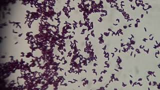 Gram Staining of Corynebacterium Species Identifying GramPositive Bacteria [upl. by Howzell]