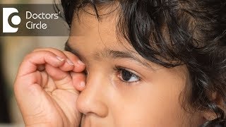 What is Strabismic Amblyopia Deprivation Amblyopia amp Refractive Amblyopia  Dr Sirish Nelivigi [upl. by Kape798]