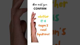 Confirmatory test for Guyon’s canal syndrome Froment’s test Ulnar tunnel syndrome shorts [upl. by Pail]