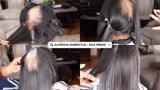 ALOPECIA NO PROBLEM HOW I COVERED ALOPECIA WITH NATURAL HAIR SILK PRESS [upl. by Ahsaelat]