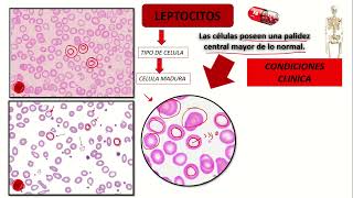 LEPTOCITOS Hematologia [upl. by Ahsuoj]