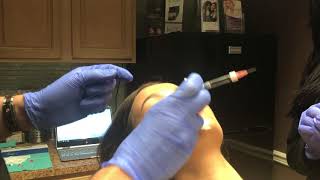 Restylane® Lip Injections with Dr Naderi [upl. by Feld]