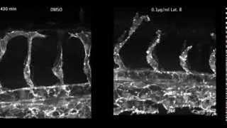 Dorsal migration of endothelial cells in zebrafish development [upl. by Alliehs307]