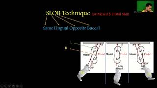 ازاي تاخد XRay ب Mesial او DistalShift يعني ايه SLOBTechnique [upl. by Sig]