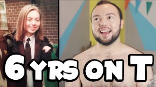 MY TRANSGENDER JOURNEY  6 Years On Testosterone [upl. by Araeit]