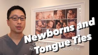 Newborns and Tongue Tie the first few days of life [upl. by Terence]