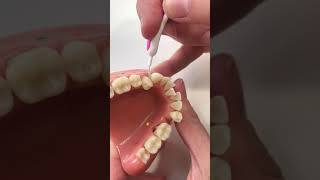 Using an Interdental Brush 2 [upl. by Otsugua]