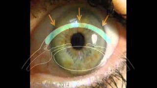 Cornea 1 A Remarkable Structure [upl. by Marius255]