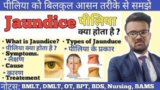 Jaundice  पीलिया   Types of Jaundice  Symptoms of Jaundice  What is main cause of jaundice [upl. by Kenny]