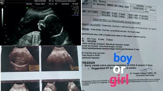 Baby Gender prediction using scanning reportplacenta positionFHRboy and girl scanning r Malayalam [upl. by Daus]