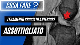 Legamento crociato anteriore assottigliato 🟠  Cosa Significa❓ [upl. by Skolnik158]