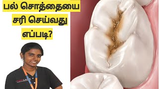 பல் சொத்தைக்கான காரணங்களும் தீர்வுகளும் Reasons treatment for tooth cavity in Tamil [upl. by Lagiba689]