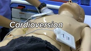 Cardioversion  Defibrillation Technique [upl. by Annodas]