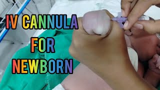 How To Insert Iv CanulaJelco  Iv Cannulation procedure  Iv Cannulation For Newborn  viralvideo [upl. by Tatianas]