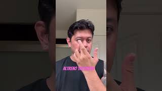 acne acnetreatment skincareroutine skincare altreno tretinoin [upl. by Milinda]