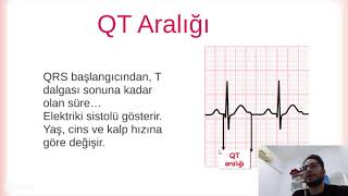 Temel EKG Okuma ve Yorumlama  Kolay ve Basit [upl. by Aynatal417]