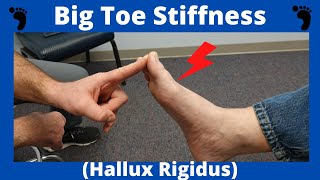 Stiff Big Toe Joint Hallux Rigidus Treatment [upl. by Naamana]