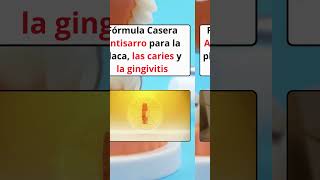 Fórmula Casera Antisarro para la placa las caries y la gingivitis shortsvideo [upl. by Enileme]