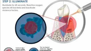 Understanding Photodisinfection [upl. by Asyl]