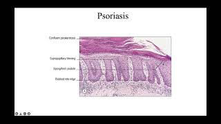 Psoriasiform reaction patterns [upl. by Oconnor]