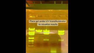 Gel Electrophoresis [upl. by Favin767]