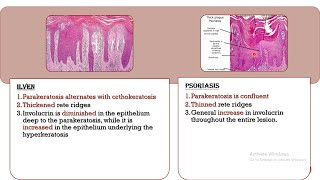 3 Psoriasiform Dermatoses  DD 2 [upl. by Locke]