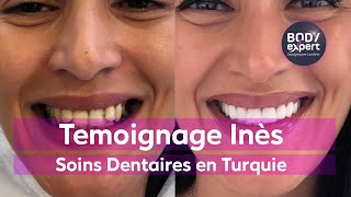 SOINS DENTAIRES  🦷 Témoignage 20 couronnes dentaires  BODYEXPERT [upl. by Leunas695]