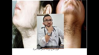 أحسن علاج لزيادة الشعر عند المرأة le meilleur traitement pour lhyperpilosité [upl. by Isle]