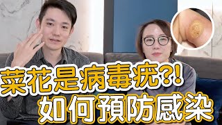 病毒疣會傳染怎麼辦？莊盈彥醫師跟蕭全佑醫師教大家如何治療及預防！ [upl. by Regina269]