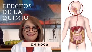 Efectos de la quimioterapia EN BOCA Hematooncología [upl. by Longerich984]