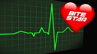 ❤️ HEARTBEAT Sound Effect 🩺 Slow to Fast Flatline and Heart Attack Sounds Bite Star [upl. by Yelreveb]