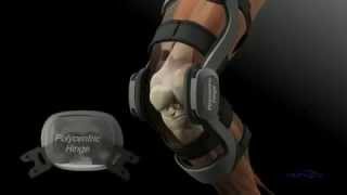 DonJoy FullForce Knee Brace at DMEDirectcom [upl. by Adranoel]