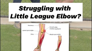 How To Identify The Scary Little League Elbow [upl. by Sacks]