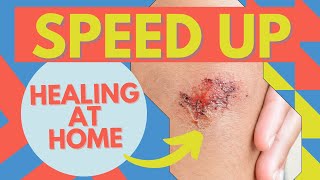 Wound Care How To Heal Faster At Home [upl. by Ayihsa]