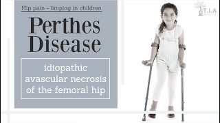 Perthes Disease LeggCalvePerthes Disease  nonsurgical treatment [upl. by Nahtanod973]