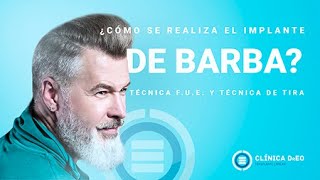 ¿Cómo se realiza el Implante de Barba Técnica FUE Técnica de Tira [upl. by Trutko]