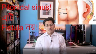 Pilonidal sinus পাইলোনিডাল সায়নাস [upl. by Enitnatsnoc]