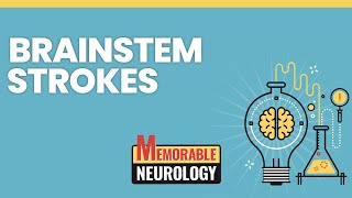 Brainstem Stroke Mnemonics Memorable Neurology Lecture 15 [upl. by Yffub270]