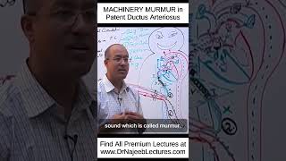 MACHINERY MURMUR In Patent Ductus Arteriosus shortvideo shorts drnajeeb lecture [upl. by Oicram519]